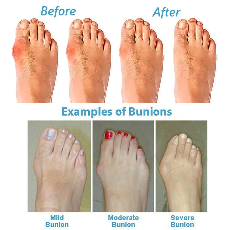 GR | Orthopedic Corrective Sandals